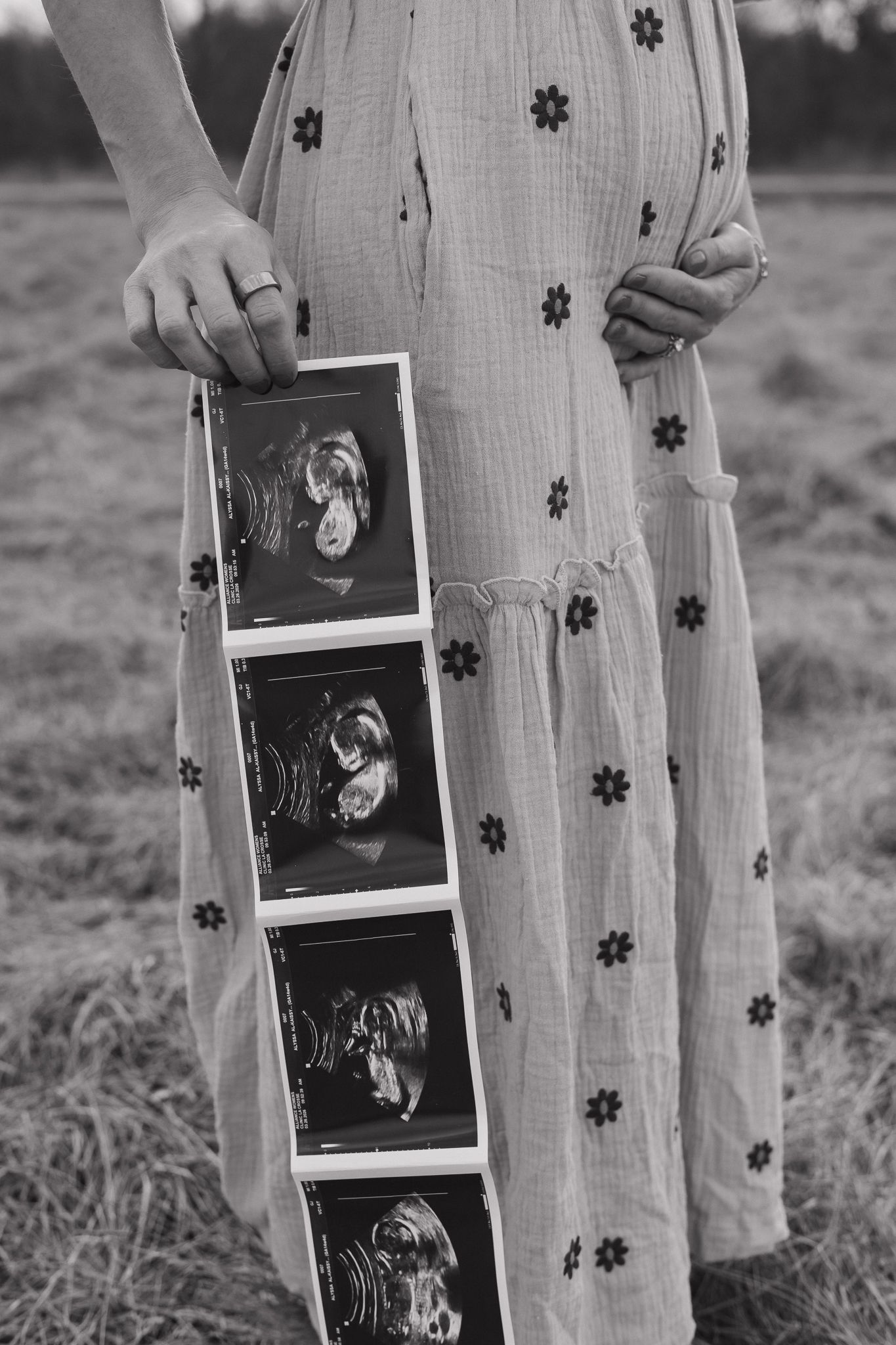Black and white photo of pregnant woman in floral dress holding ultrasound images in an outdoor field.