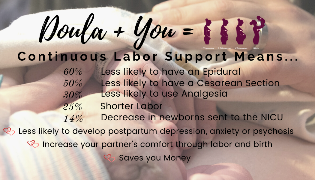 Statistics showing benefits of doula support including reduced cesarean rates and shorter labor times.