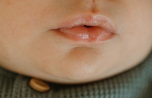 Close-up macro photograph of glossy pink lips against pale skin wearing a green turtleneck sweater.