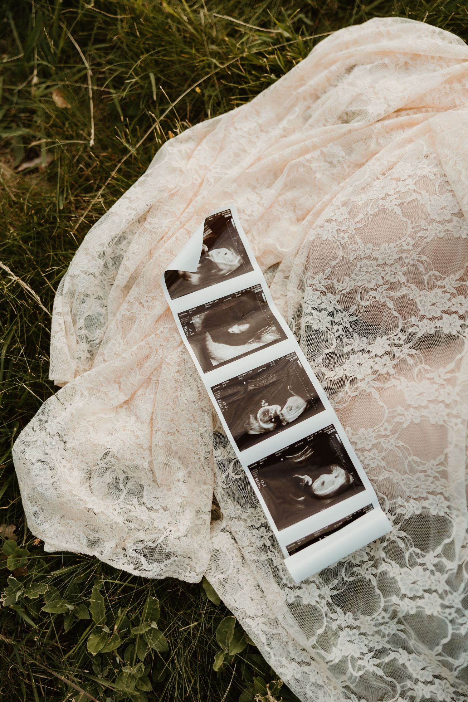 Ultrasound photos displayed on delicate white lace fabric against green grass background in a series of artful arrangements.