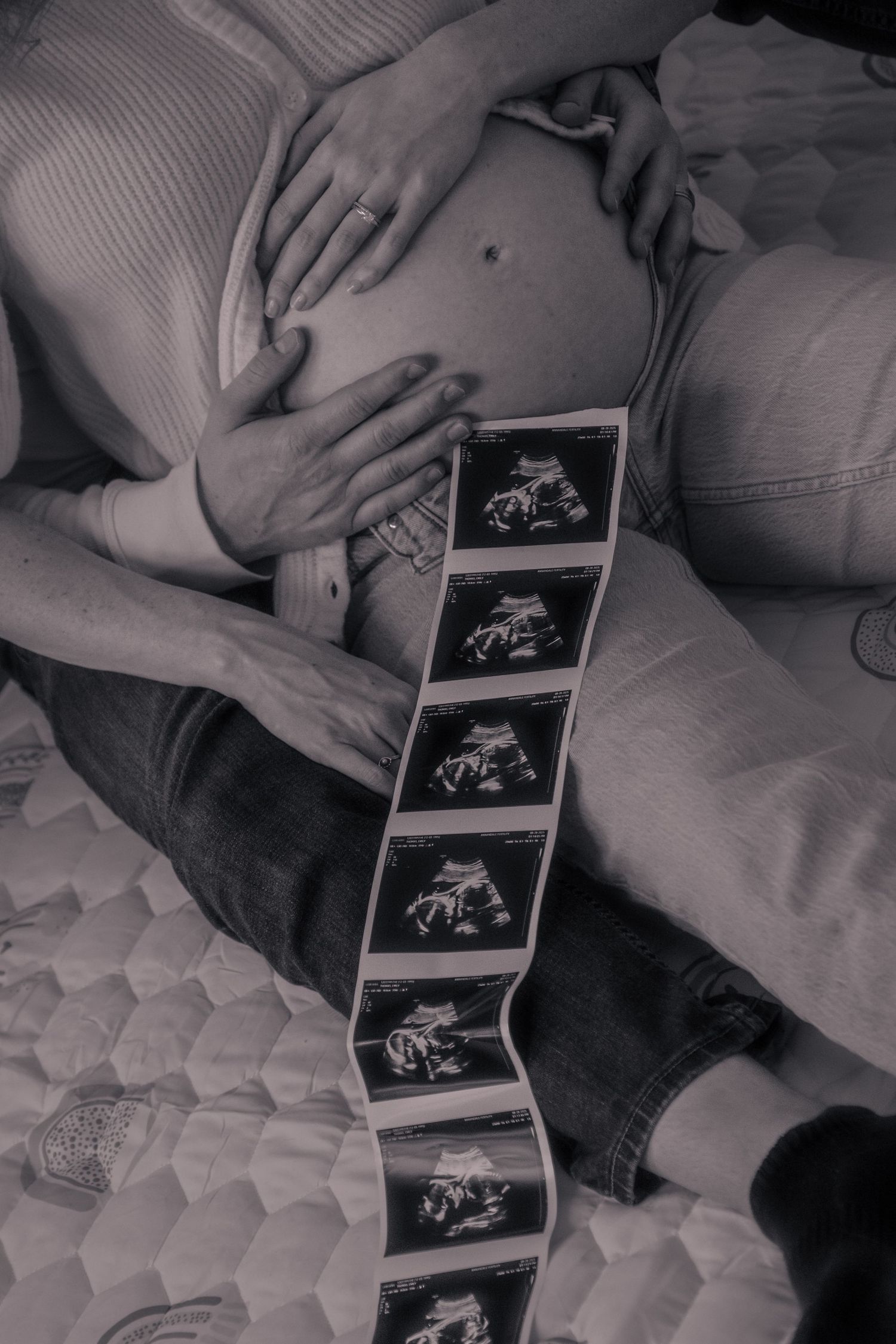 Black and white ultrasound photos arranged in a row on a textured surface showing pregnancy progression.