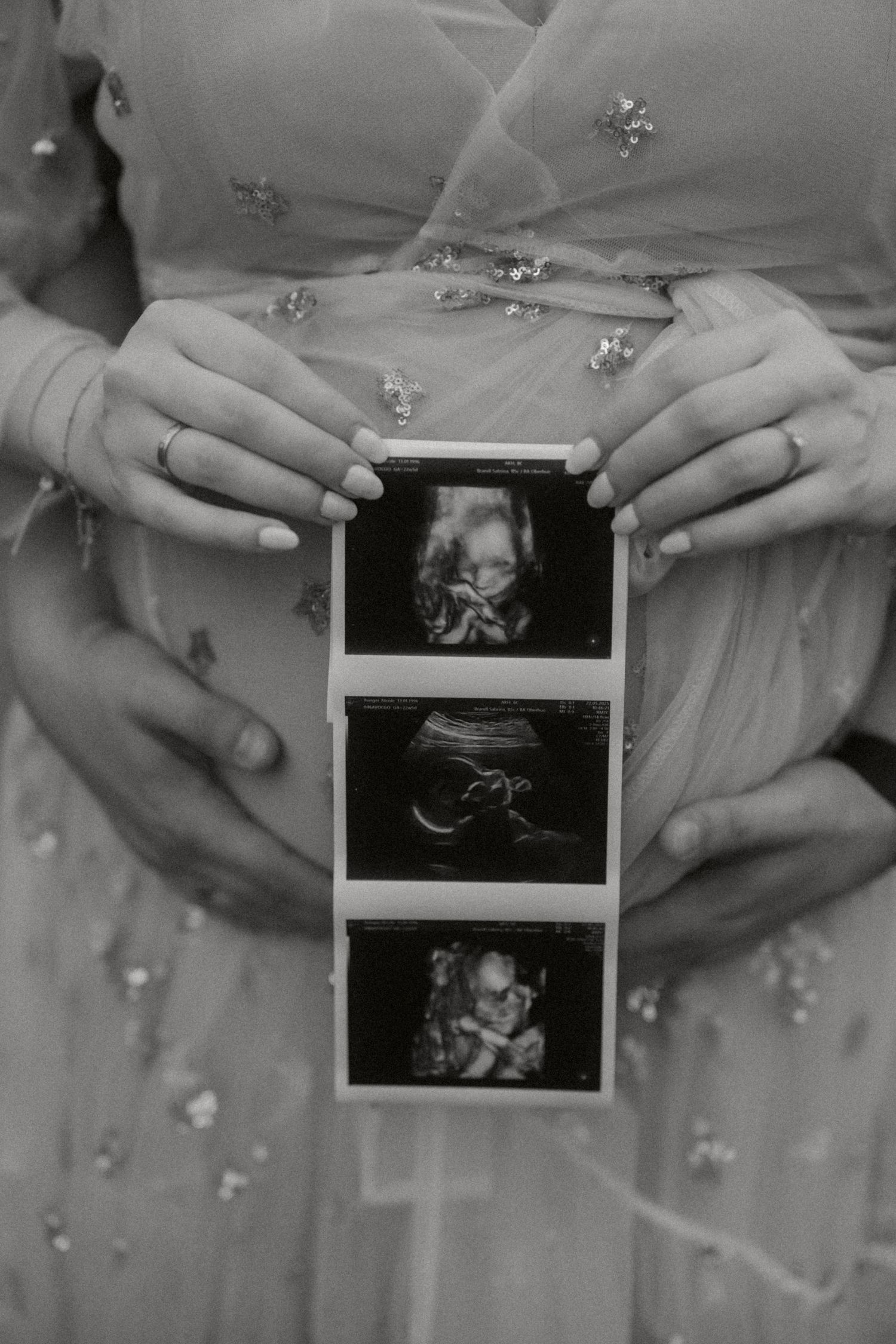 Babybauch Shooting Wien Outdoor mit emotionalen und natürlichen Schwangerschaftsbildern