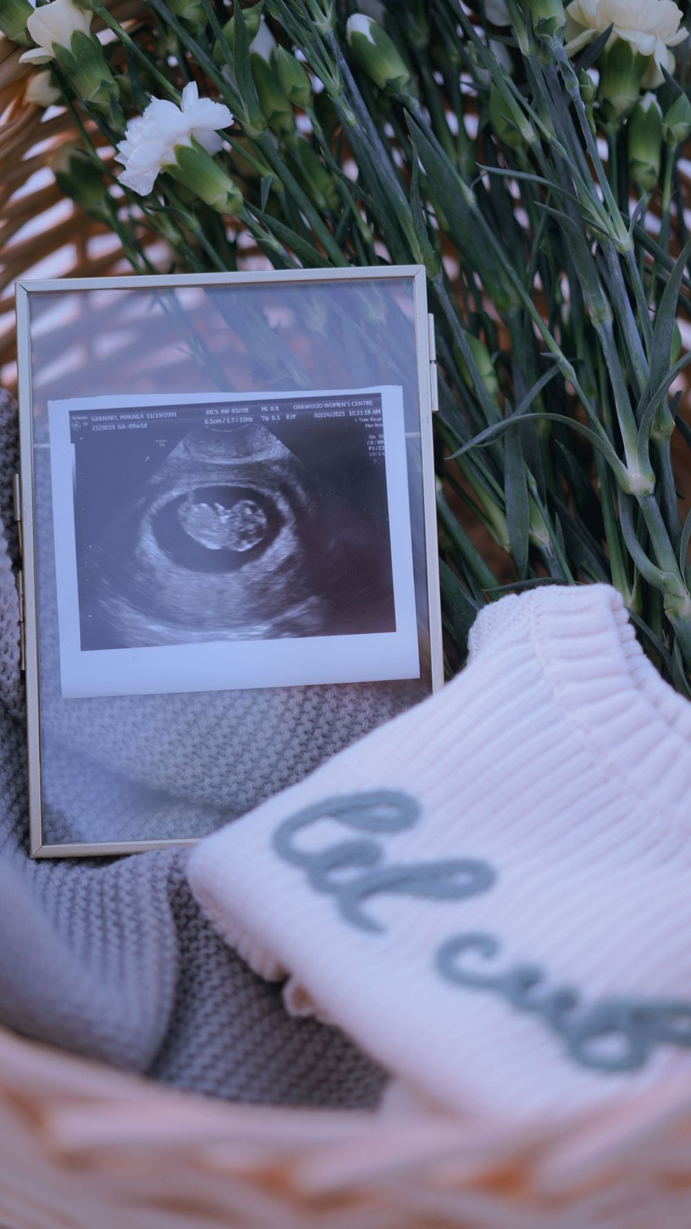 Ultrasound sonogram photo displayed with white flowers and knitted baby items in a pregnancy announcement setting.