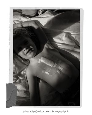 Black and white photo showing medical bandages and dressings.