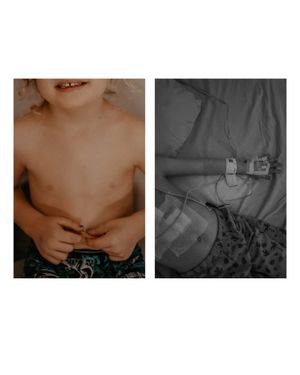 Collection of two photos showing torso and medical equipment.