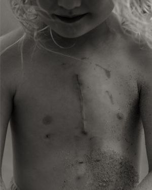 Black and white close-up of sandy skin with scratches and marks.