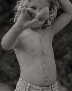 An artistic black and white photo showing scratches and marks on skin.