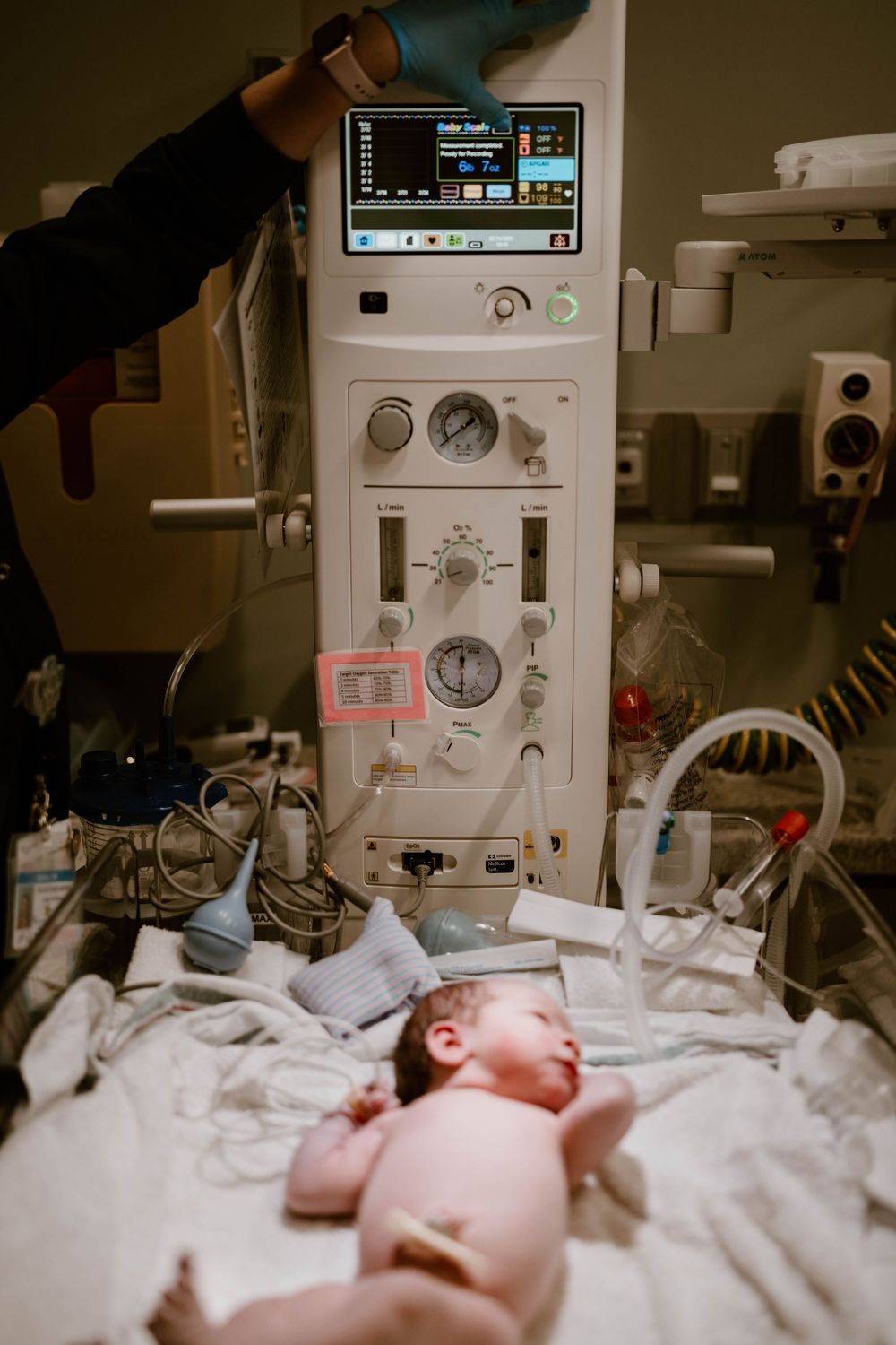 Medical equipment and monitors surround a newborn baby resting on white hospital bedding.