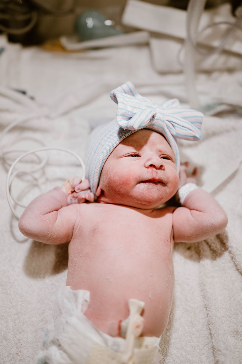 A newborn baby stretches and yawns while lying on soft white bedding in a hospital setting.