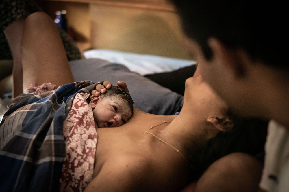 Baby awake on mother’s chest during skin to skin bonding after birth