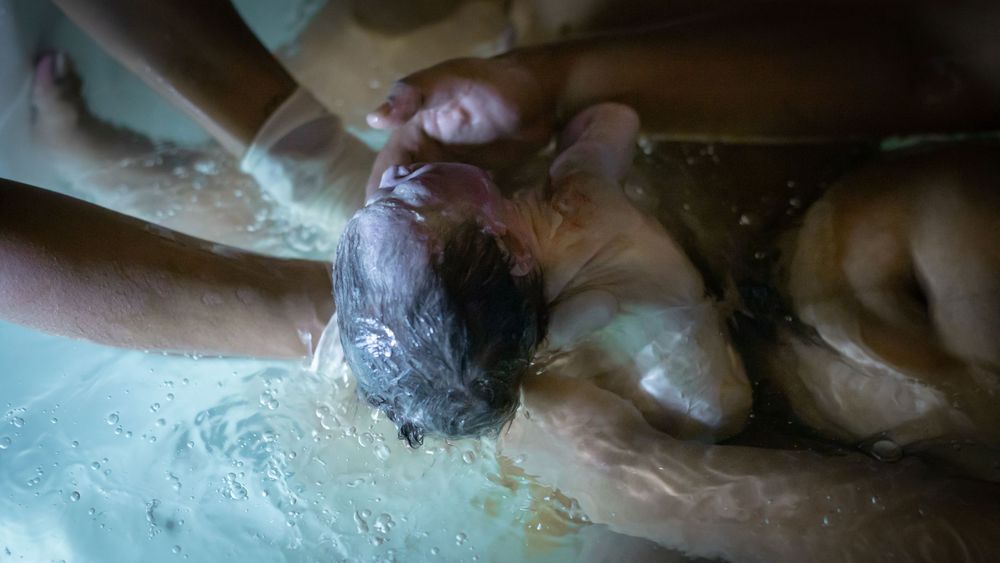 Baby emerging gently in water during a water birth supported by hands