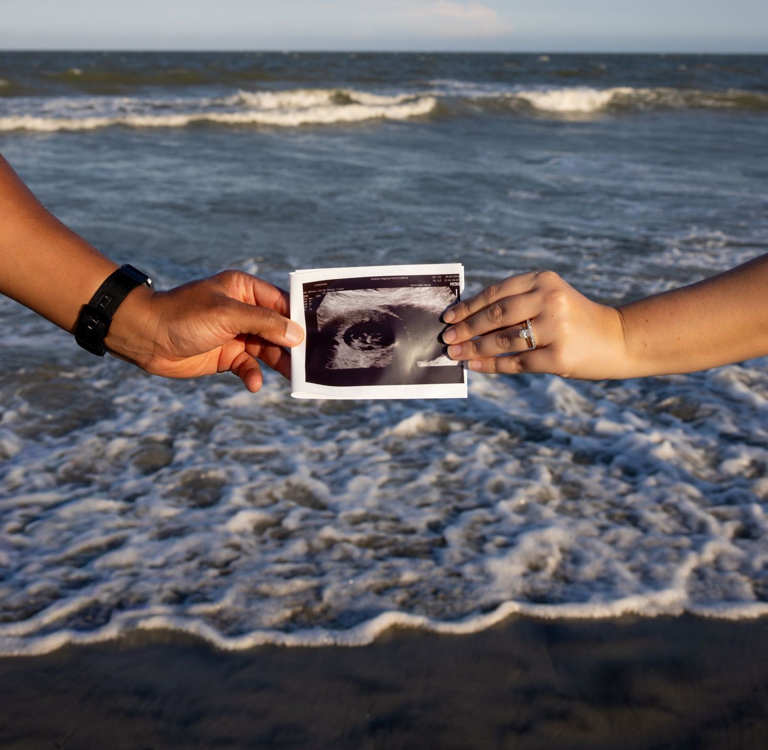 Two hands holding a black and white photo of an eye together on a beach with ocean waves in the background.