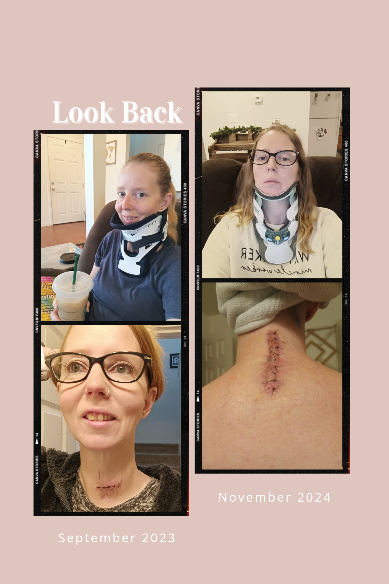 Medical recovery progress photos showing healing stages.