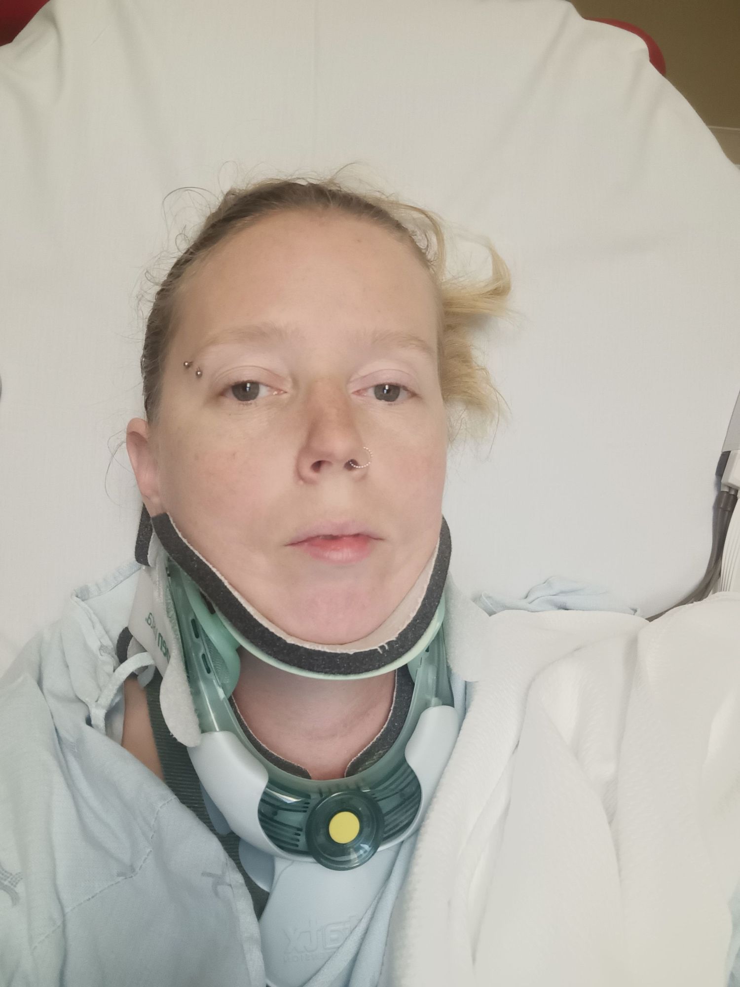 Patient wearing medical neck brace in hospital bed.