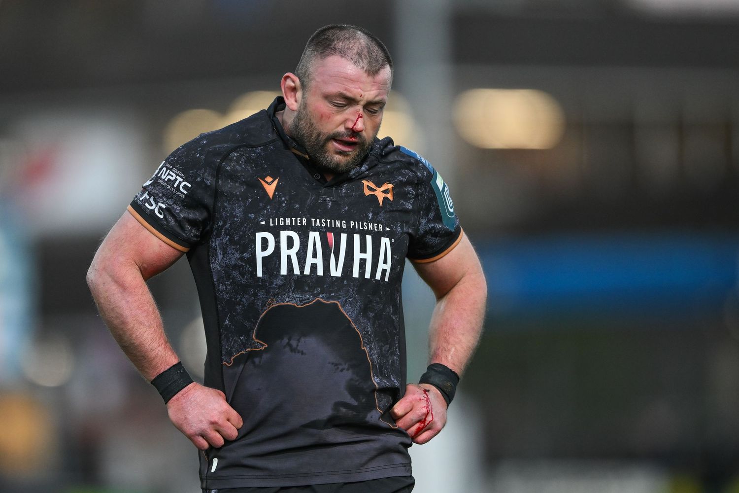 Rugby player in dark Pravha sponsored jersey stands on field with blood on shirt during match.