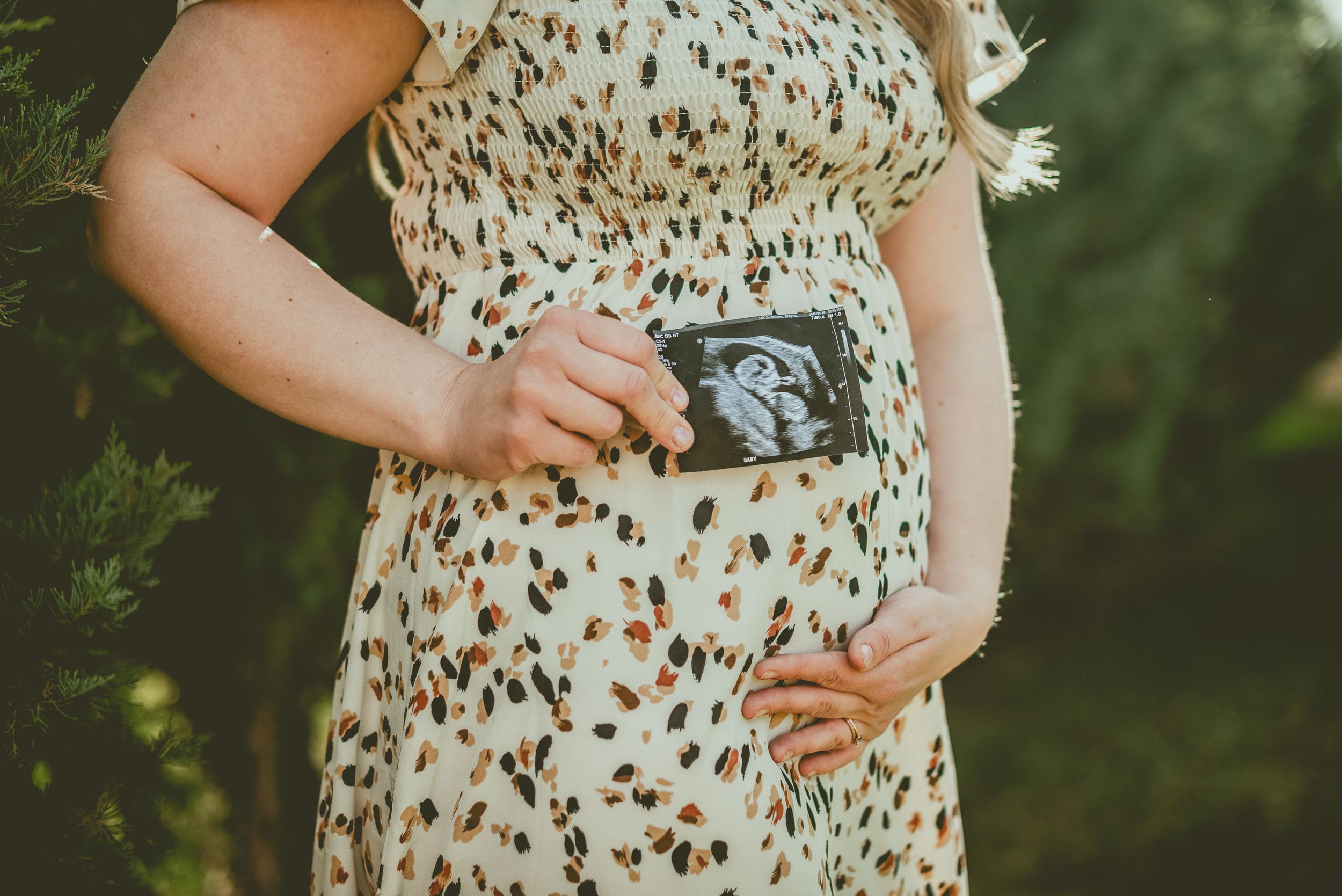 Pregnant person in floral dress holds ultrasound photo against belly in outdoor maternity photoshoot.