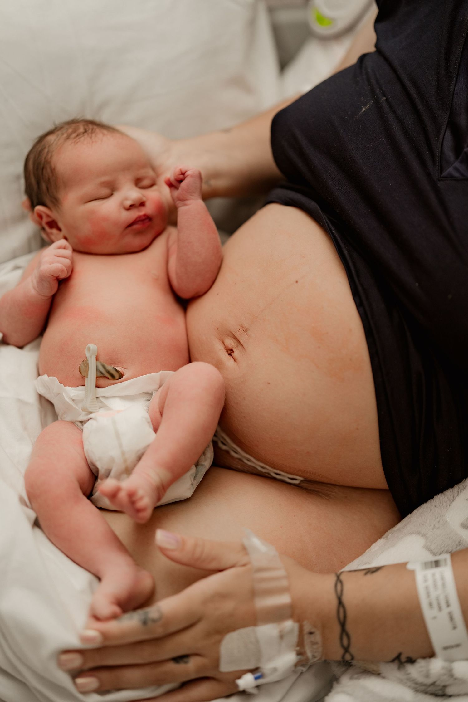 Newborn baby resting on mother's postpartum belly in hospital bed after birth.