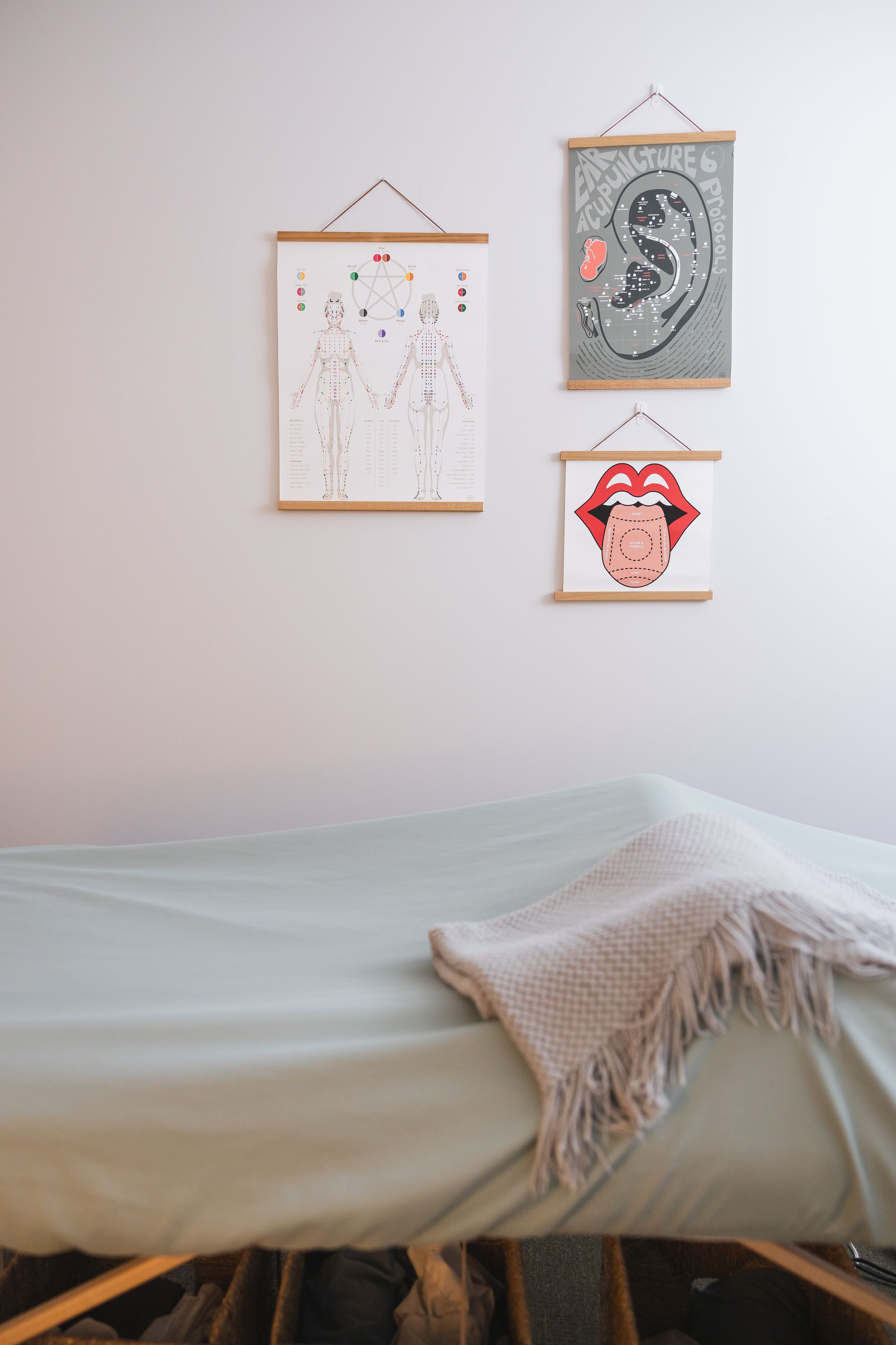 maple valley acupuncture photo of massage table and acupuncture wall art of tongue, chi and meridian energy lines