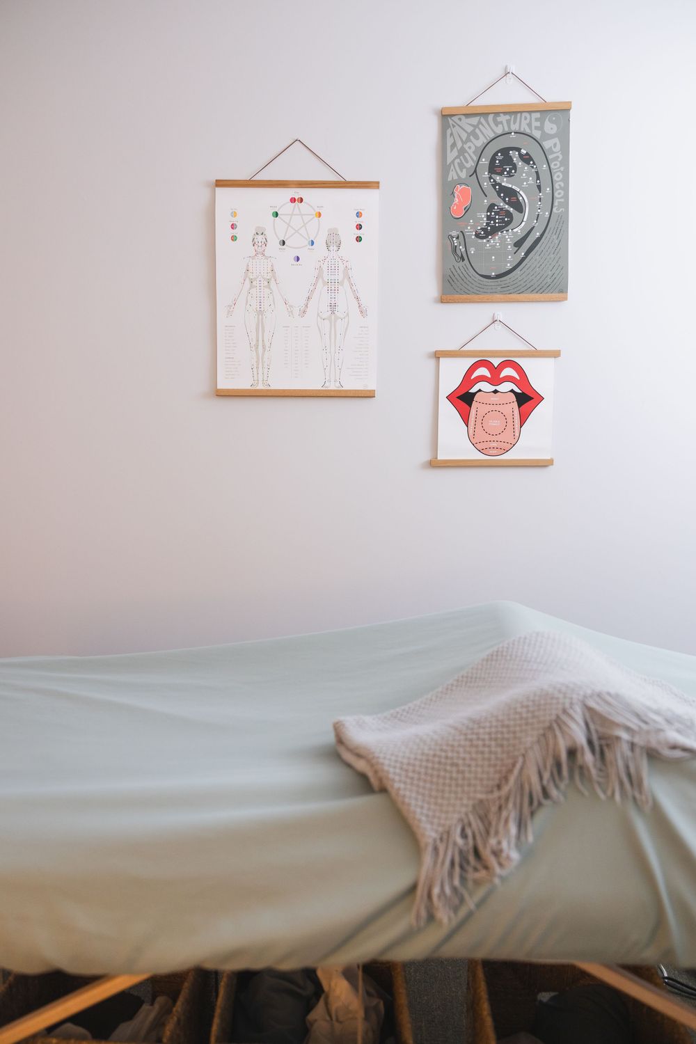 maple valley acupuncture photo of massage table and acupuncture wall art of tongue, chi and meridian energy lines