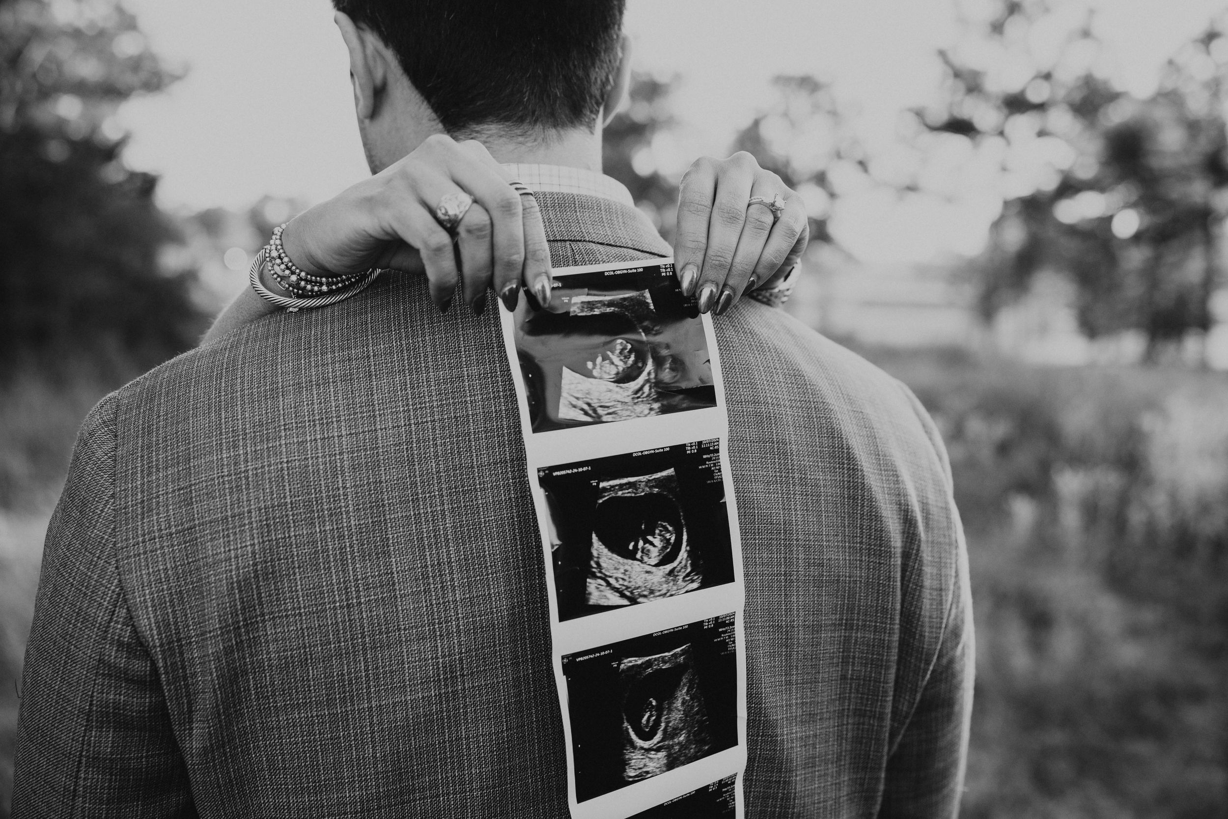 Man in suit jacket with ultrasound photos tucked in back, creative black and white pregnancy reveal photo.