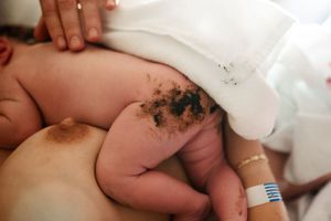 Close-up of newborn baby with meconium stains being cleaned after birth.