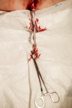 Medical clamps and surgical tools with blood on white medical sheets.