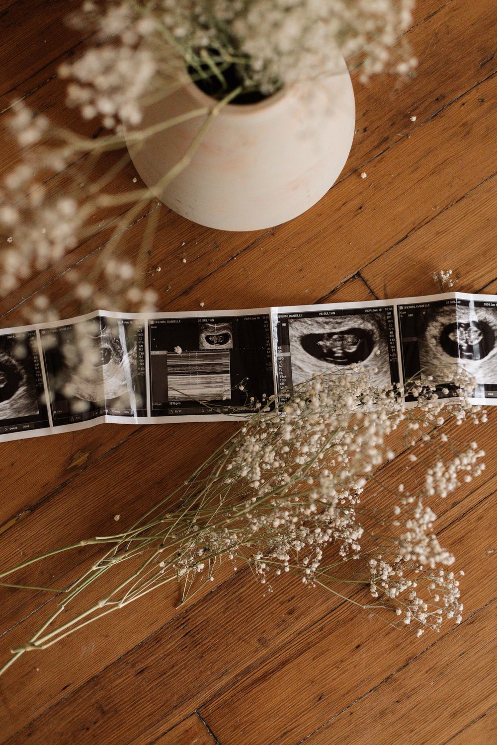 Ultrasound images arranged with baby's breath flowers on wooden floor creating pregnancy announcement.