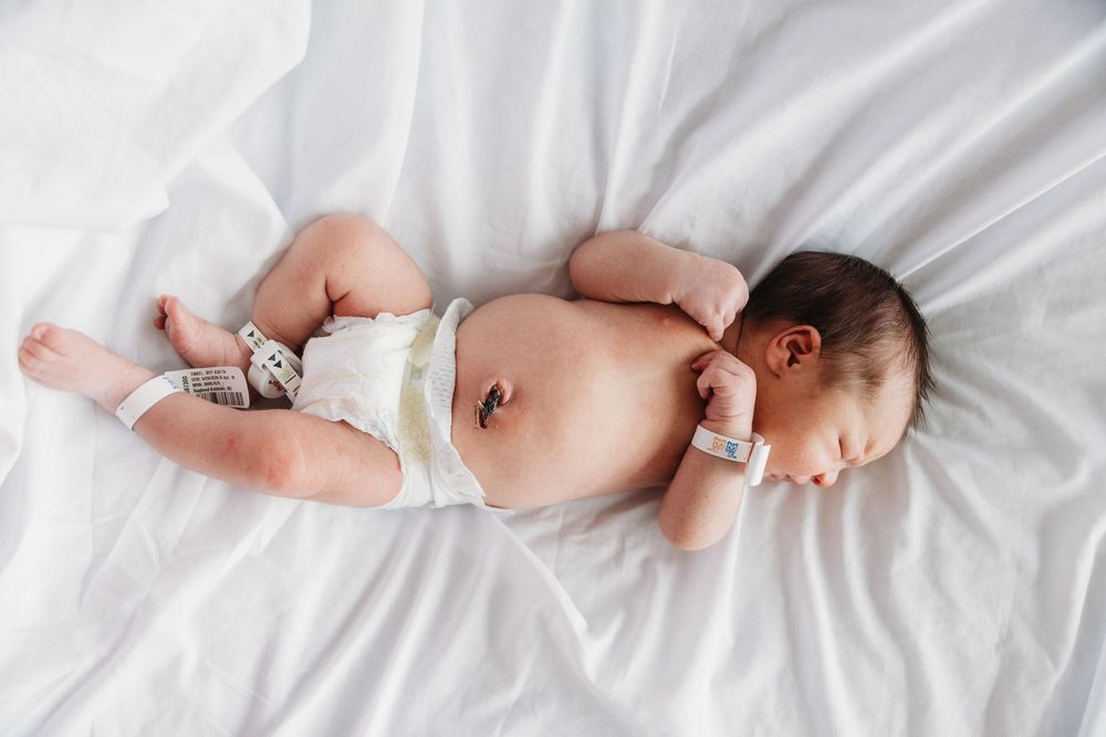 Newborn baby sleeping peacefully on white sheets wearing a diaper, with hospital ID bracelet on wrist.