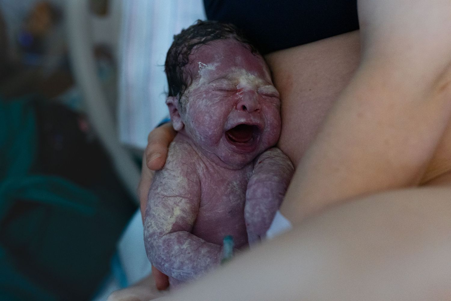 Birth Photography