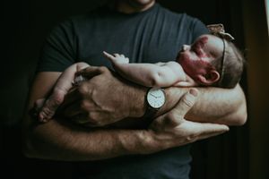 Father in gray shirt cradling a newborn baby with a birthmark in his arms.