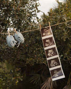 Baby booties and ultrasound strip photos hanging on twine clothesline among green foliage outdoors.