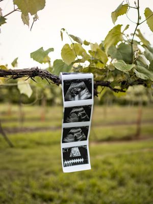 Ultrasound photos and sonogram images hanging from twine against a blurred green outdoor background.