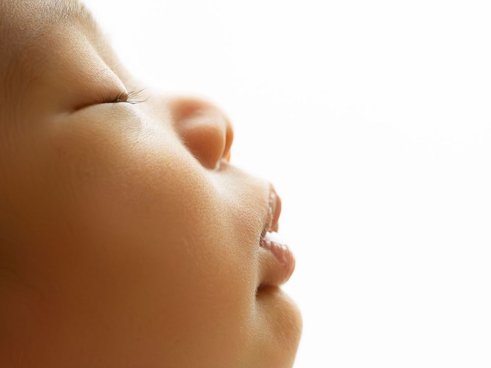 Close-up profile view showing lips and nose against white background.