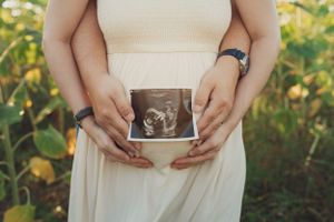 Hands hold an ultrasound photo against a white dress in a sunny outdoor setting.