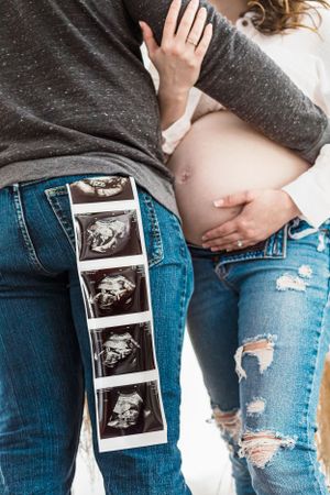 Maternity photo with ultrasound strip showing baby scans laid across distressed denim.