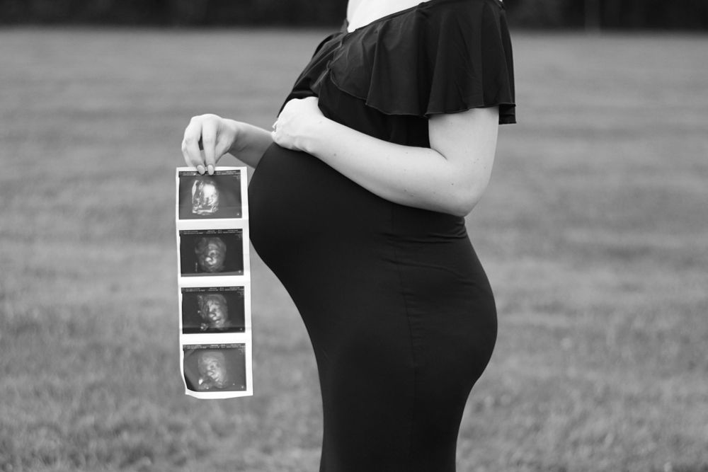 Black and white photos of a pregnant woman in an off-shoulder dress holding ultrasound images.