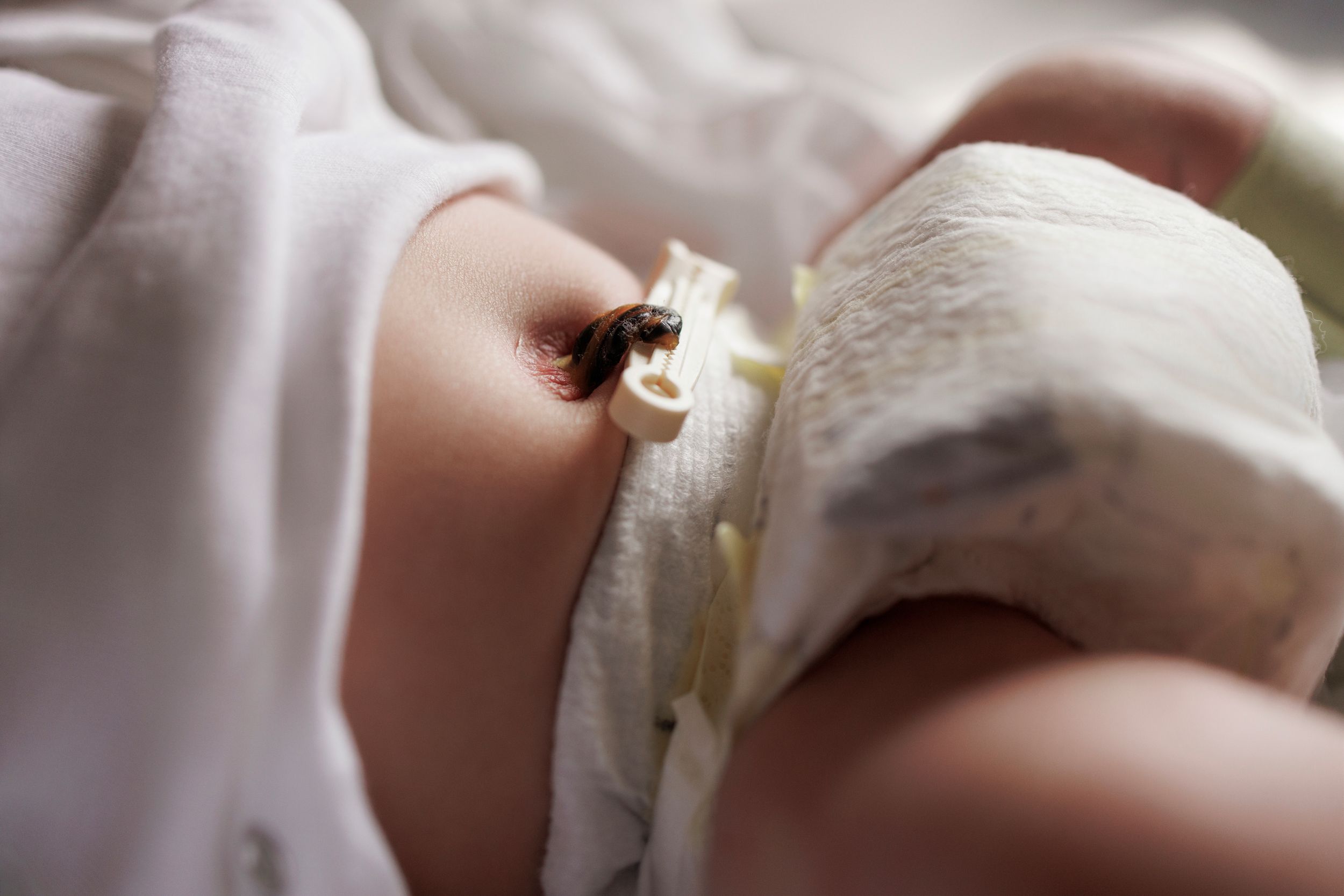 Close-up of a newborn baby's umbilical cord stump healing naturally while wearing a white diaper.