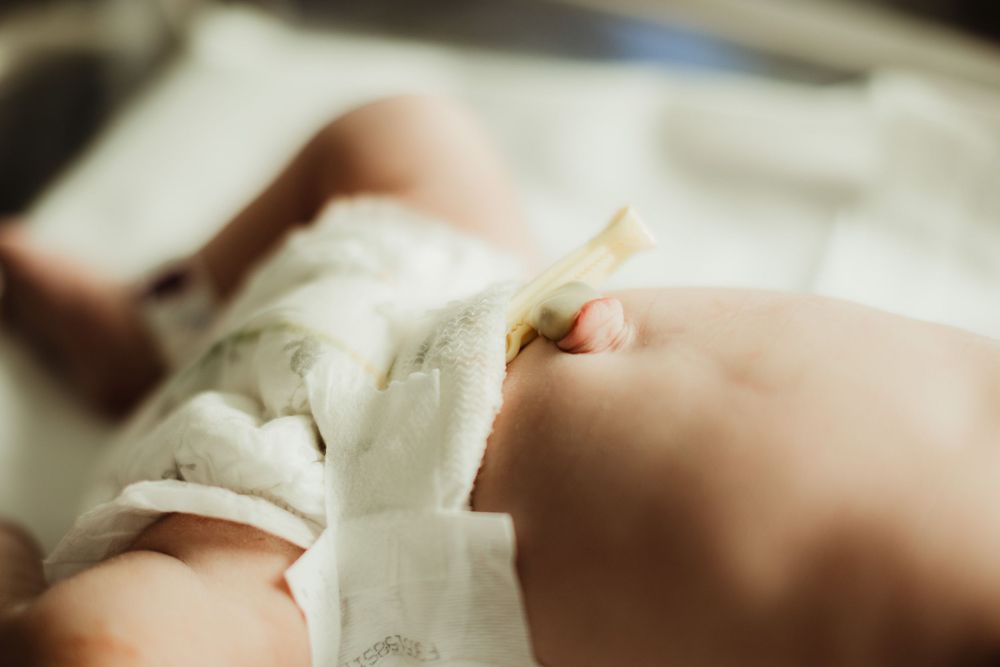 Newborn baby in diaper with umbilical cord clamp visible, lying on hospital surface after birth.