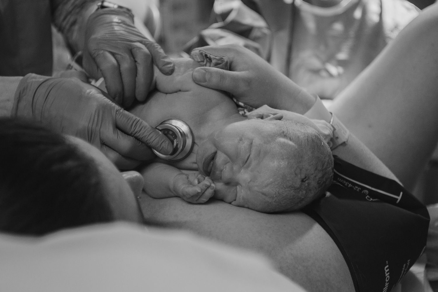 Black and white photo of hands performing a medical procedure on a patient lying on an examination table.