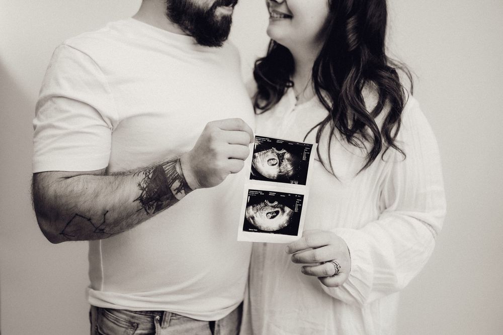 Black and white photo of couple holding ultrasound images close together.