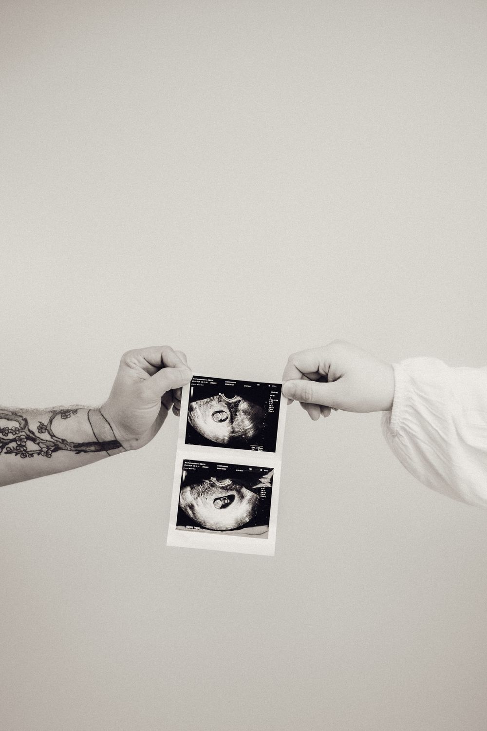 Two hands holding ultrasound scans, one tattooed, black and white photo.