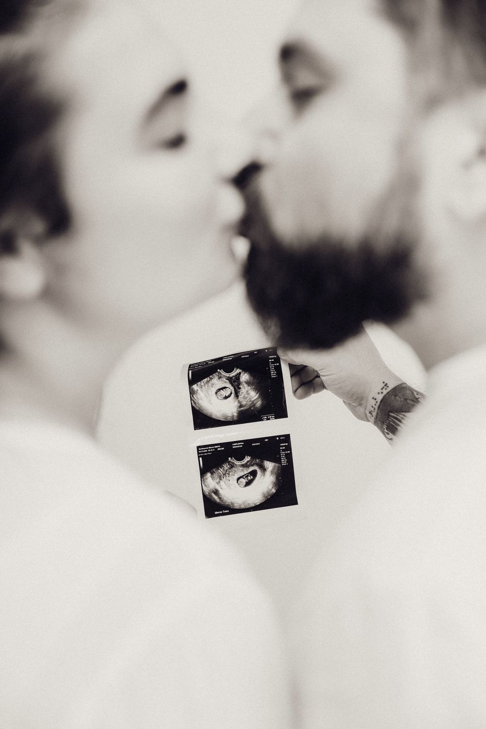 Black and white close-up of a couple kissing while holding ultrasound scan photos between them.