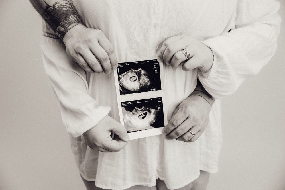 Couple holding ultrasound photos in black and white, showing tattooed hands and an engagement ring.