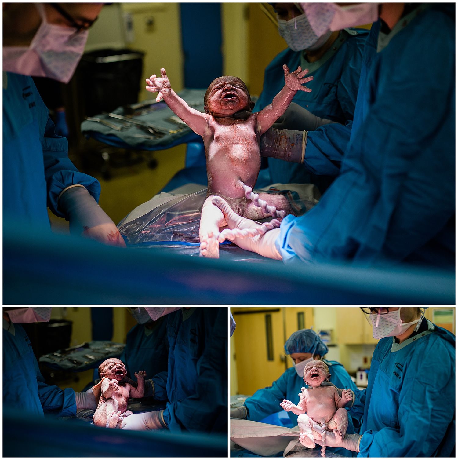 A newborn baby cries during their first moments after delivery in a hospital setting.