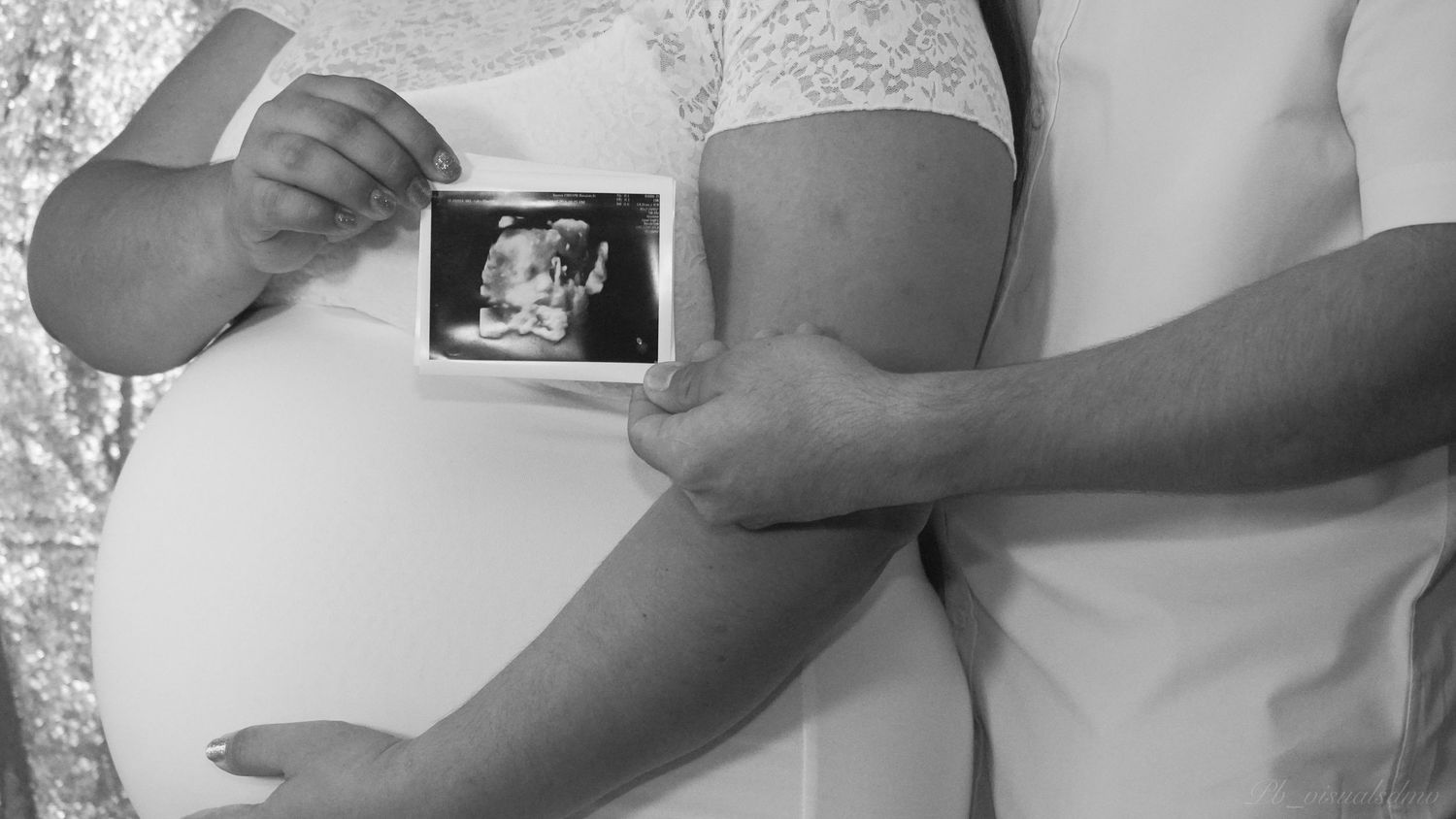 Black and White photo of a couple and their sonogram, capturing a intimate moment