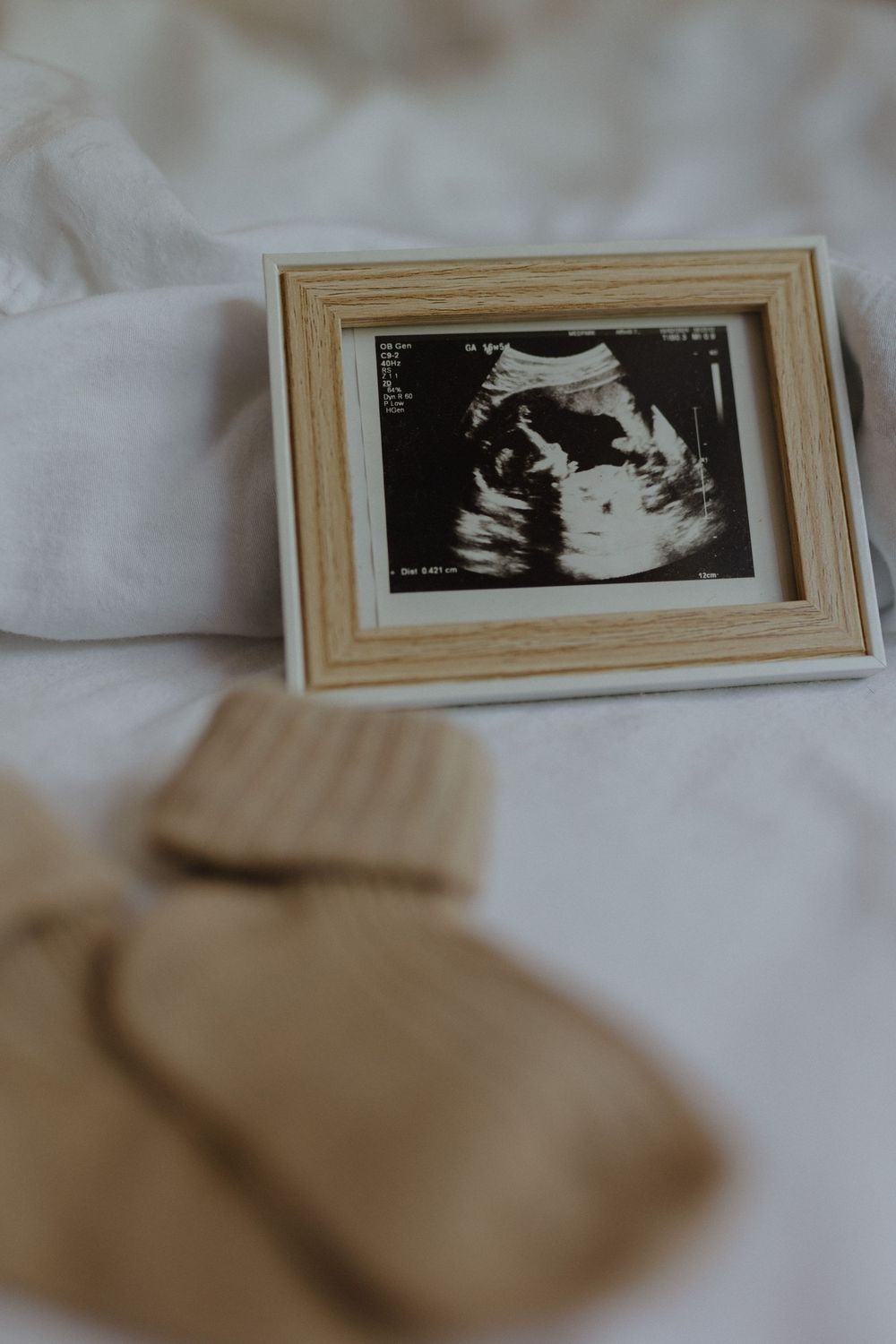 Three black and white ultrasound scan photos displayed on a light colored surface show fetal development images.