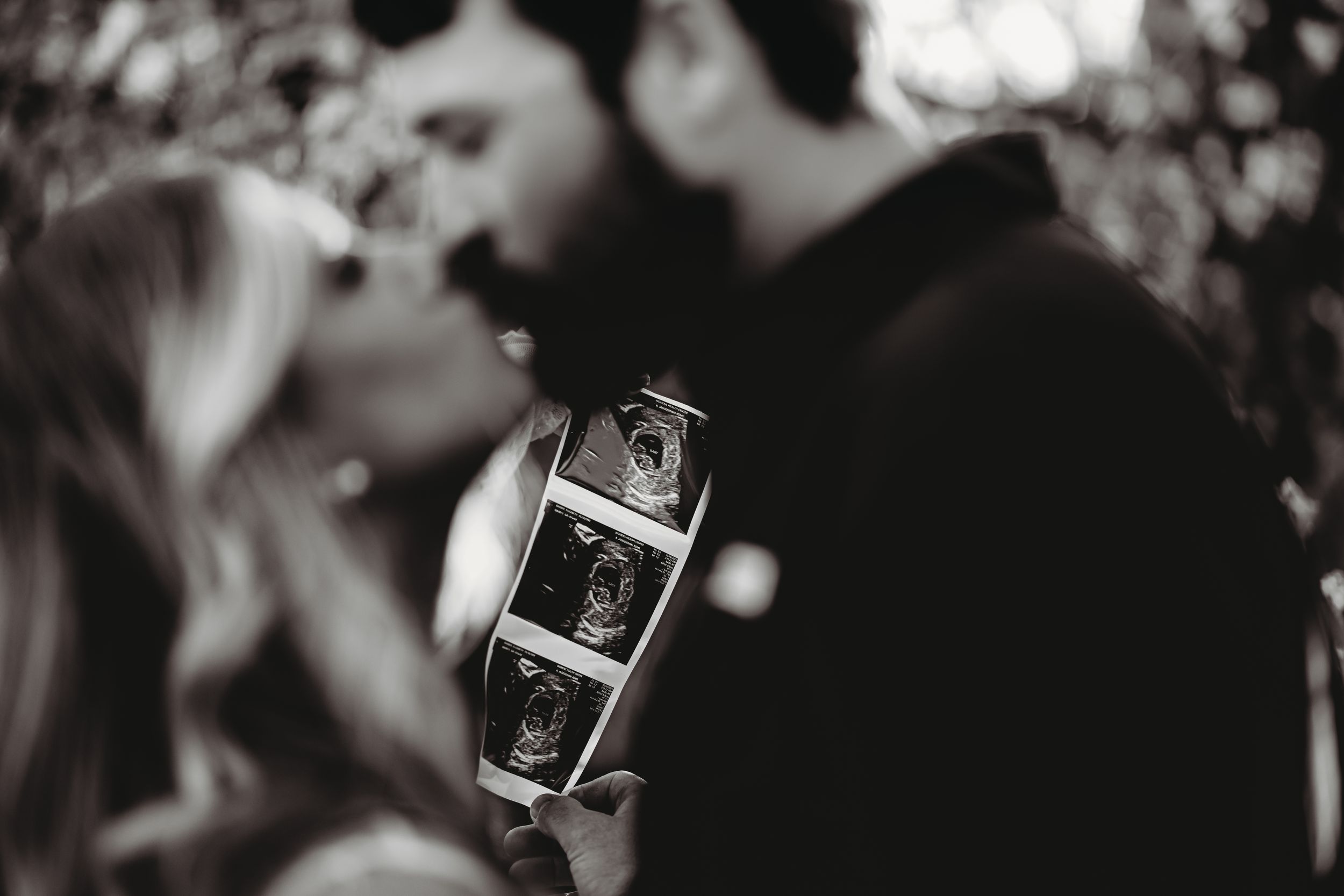 Black and white photo of ultrasound images being held during a pregnancy announcement.