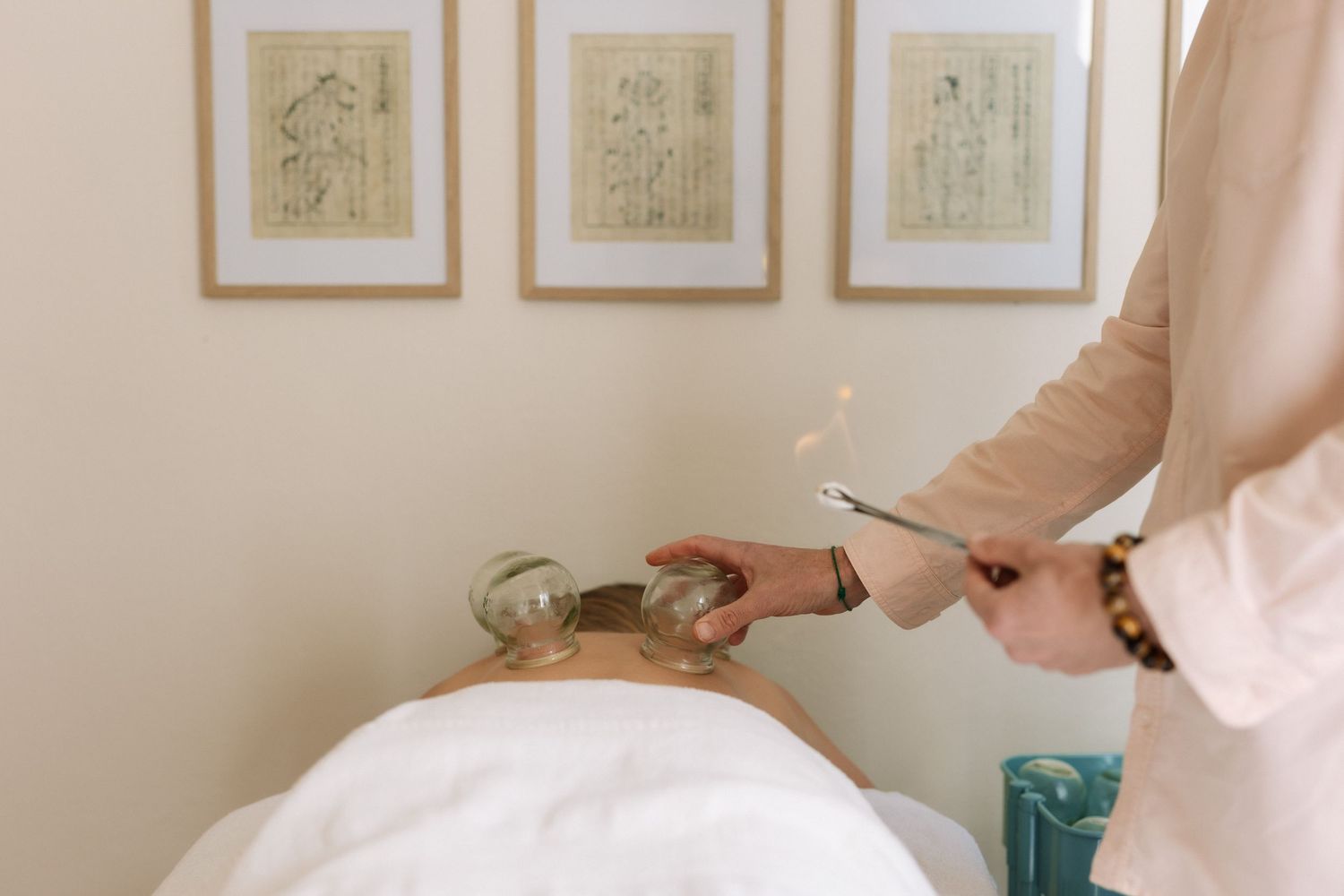 Practitioner performing fire cupping therapy on a patient's back in a serene spa treatment room.