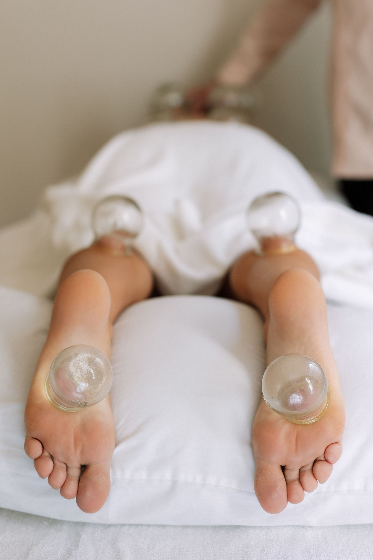 Person receiving cupping therapy treatment on legs and feet, lying on white massage table.