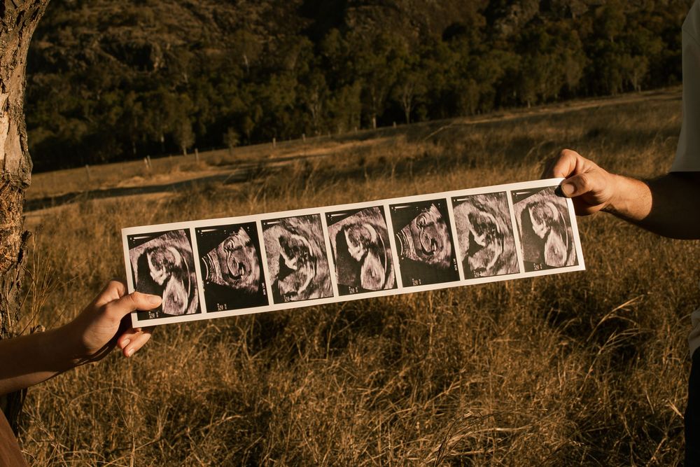 Two hands holding an ultrasound strip with multiple baby scan images outdoors in a golden field.